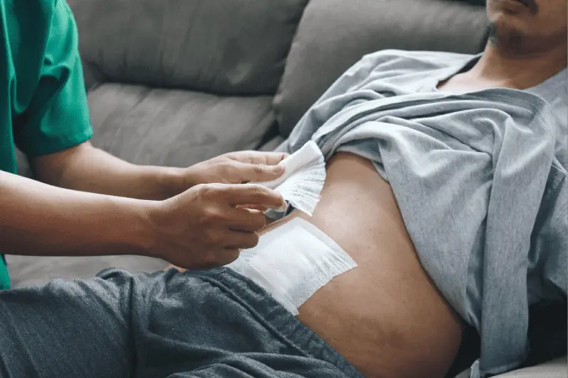 Información sobre el Costo de especialista en coloproctología en Benito Juárez CDMX
